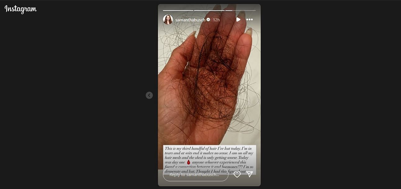 Samantha's story on July 7 - Source: via @samanthabusch on Instagram